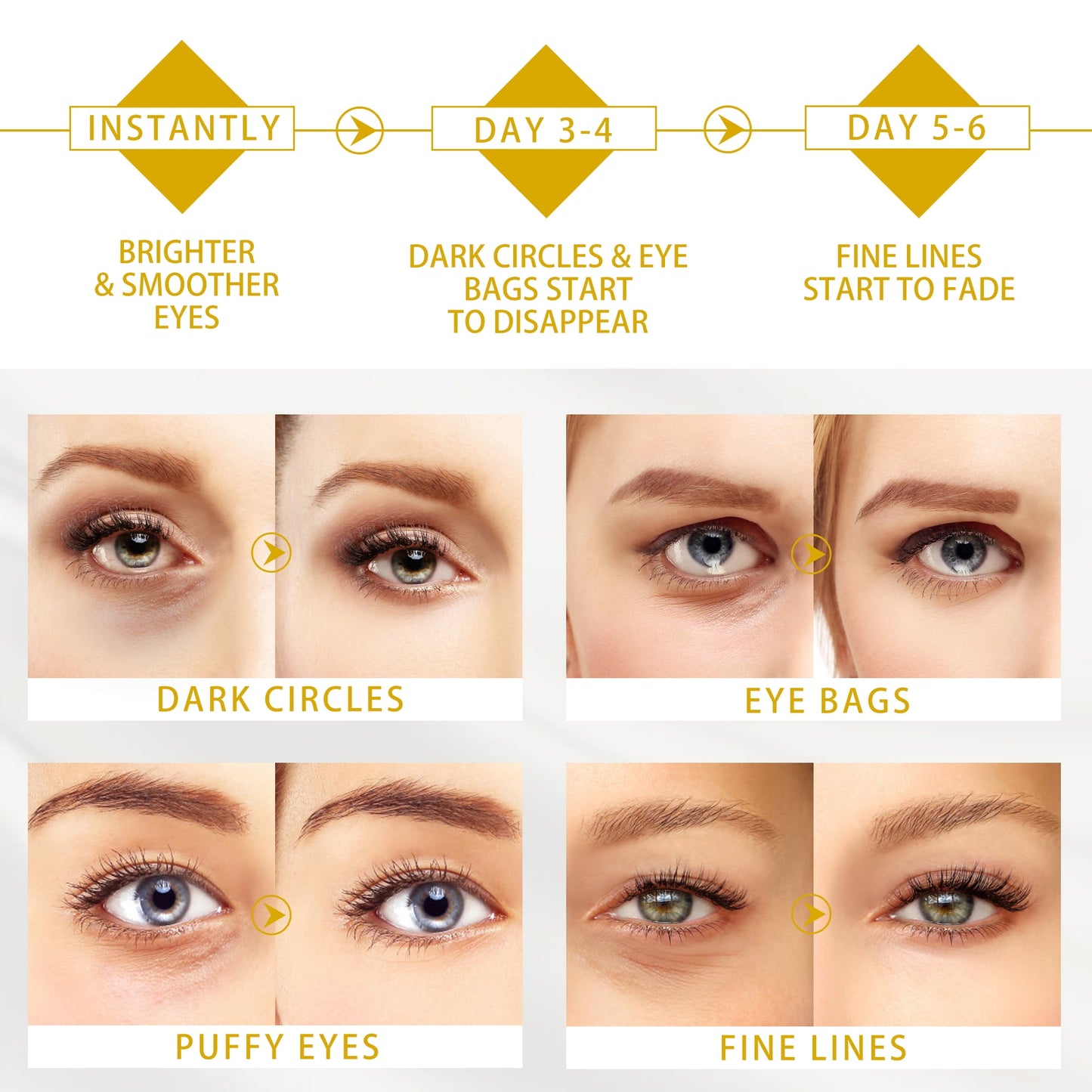 Vanelc 24K Gold Eye Patches, 30 Pairs Under Eye Mask for Dark Circles & Puffy Eyes - VANELC